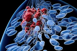 2019 04 15 22 17 2307 Breast Cancer 400