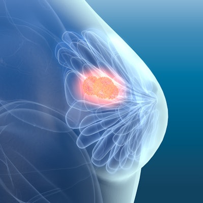 What I Wish I Had Known About Breast Cancer – Dense Breasts Canada