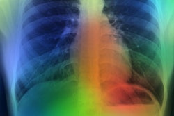 2022 09 16 21 47 3714 Artificial Intelligence Lung Color 400