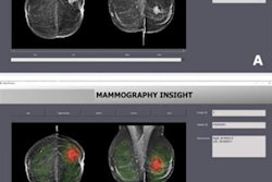 2023 05 02 00 26 1862 2023 05 02 Radiology Ai Mammo Interface 20230502000950
