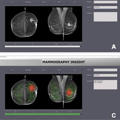 2023 05 02 00 26 1862 2023 05 02 Radiology Ai Mammo Interface 20230502000950