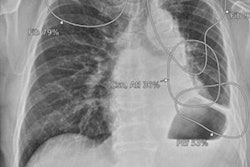 2023 05 03 22 14 6697 2023 05 04 Ai Chest 20230503221347