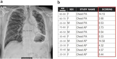 Integration of AI for chest x-rays on PACS. (a) The AI result attached to the second image of the original chest x-ray contains a contour map, abbreviations, and the abnormality score of detected lesions. Doctors can simply refer to the AI results by scrolling down the original image on the PACS. (b) The highest abnormality score is used as the total abnormality score of each image, and this was listed as a separate column (red square) on the PACS. Image and caption courtesy of npj Digital Medicine through CC BY 4.0.