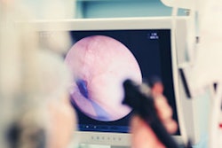 2023 05 05 18 08 3070 Endoscopy 400