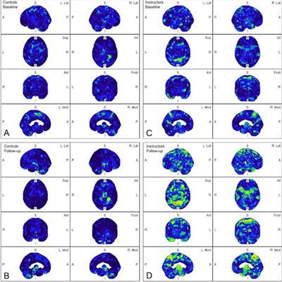 2023 05 09 23 35 3627 2023 05 09 Pet Tbi Ad 20230509230615