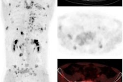 2023 05 10 23 55 3178 2023 05 11 Heterodimer Pet 20230510231909