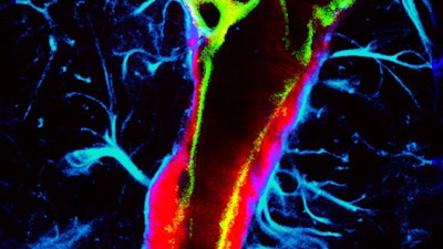 This microscopic image reveals the enhanced glymphatic transport of an intranasally delivered tracer (red), achieved using ultrasound combined with microbubbles. Image courtesy of the Chen Lab, Washington University in St. Louis.