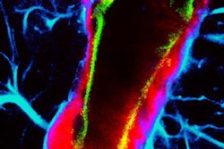 2023 05 18 17 58 0725 2023 05 15 Ultrasound Microbubbles Brain 20230518171633