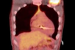 2023 05 22 21 46 4171 2023 05 23 Pet Tissue Burn 20230522220405