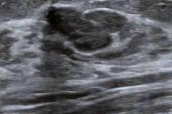 2023 05 25 22 58 6159 2023 05 24 Ajr Breast Ultrasound Cad1 20230525221522