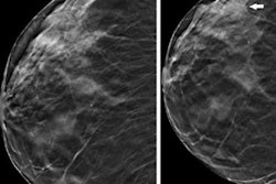 2023 05 30 22 04 7566 2023 05 30 Radiology Dbt 20230530222603