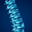 2017 01 23 10 15 18 149 Spine 400