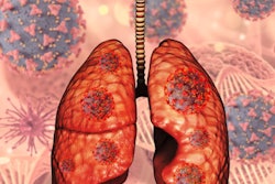 2022 07 08 17 35 8457 3 D Lungs Covid Virus Cells 400