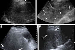 2023 05 31 21 50 1370 2023 05 30 Radiology Hcc Ultrasound 400