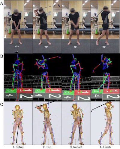 Patient's (recreational right-handed golfer) driver golf swing. (A) Actual driver swing scene, (B) Motion capture system (VICON), (C) Musculoskeletal modeling system (AnyBody). Image and caption courtesy of Scientific Reports.