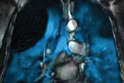 2023 06 03 17 01 2174 2023 06 02 Philips Xenon 20230603175526