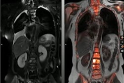 2023 06 04 02 49 0262 2023 06 04 Pet Mri Cancer 20230604023246