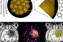 2023 06 04 20 45 9958 2023 06 04 Mri Contrast 20230604201238