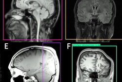 2023 06 05 17 04 8704 2023 06 05 Vita Lenz 20230605175657