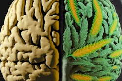 2023 06 05 17 38 6592 Cannabis Brain 400