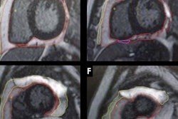 2023 06 06 16 50 5849 2023 06 04 Ismrm Mri Hiv 20230606165647