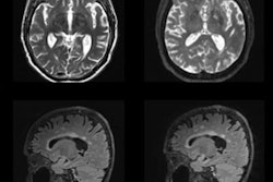 2023 06 07 23 10 1733 2023 06 08 Ismrm Mri Dementia 20230607232441