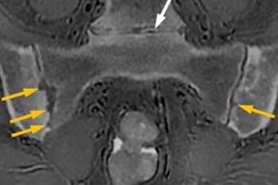 2023 06 07 23 56 6836 2023 06 07 Mri Insider Image 20230607233611