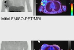 2023 06 08 21 47 6240 2023 06 06 Pet Mri Breast 20230608213714