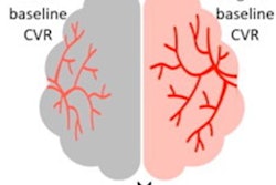 2023 06 09 16 37 1796 2023 06 07 Ismrm Mri Stroke 20230609162659