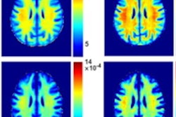 2023 06 13 15 57 8082 2023 06 14 Ismrm Hypertension Image 20230613155853