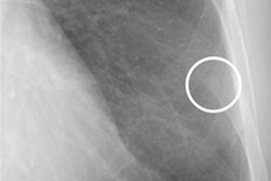 2023 06 19 16 11 5146 2023 06 16 Des X Ray 20230619165026