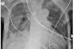 2023 06 19 21 04 5349 2023 06 20 Ai Pneumonia 20230619210953