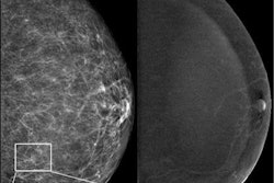 2023 06 20 22 50 3281 2023 06 20 Radiology Cem Ai 20230620220544