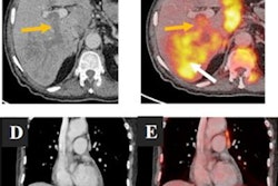 2023 06 22 23 04 9721 2023 06 23 Pet Pvt 20230622231003