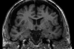 2023 06 23 21 48 5937 2023 06 26 Age Brain Juxtaposition 20230623213334
