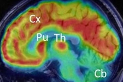 2023 06 25 00 42 9458 2023 06 25 Snmmi Pet Brain Tracer 20230625005536