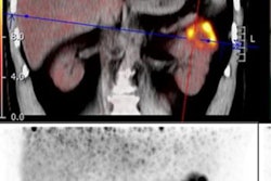 2023 06 26 20 28 2153 2023 06 26 Snmmi Kidney Tracer Pet 20230626203550