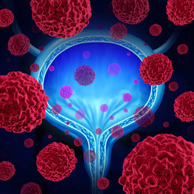 Bladder Target Image SNMMI: New therapeutic target discovered for bladder cancer | AuntMinnie