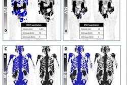 2023 06 27 20 02 3268 2023 06 28 Snmmi Prostate Treatment Intervals Figure1 20230627205644