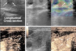 2023 06 27 23 08 7077 2023 06 27 Ultrasound Thyroid Multimodal 20230627230924