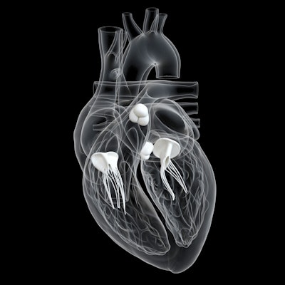 2022 11 03 18 48 6527 Heart Valves 3 D 400