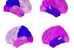 2023 06 30 22 06 3636 2023 07 03 Snmmi Alzheimers Figure 20230630220314