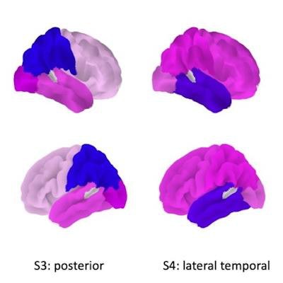 2023 06 30 22 06 3636 2023 07 03 Snmmi Alzheimers Figure 20230630220314