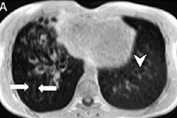 2023 07 07 20 14 4610 2023 07 07 Synthetic Ct 400