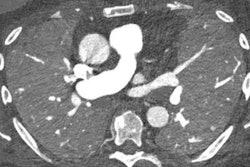 2023 07 10 21 42 6496 2023 07 11 Pcct Lung Figure10 20230710212455