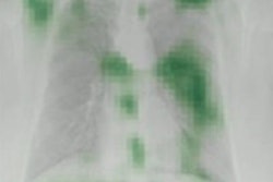 2023 07 10 23 45 2957 2023 07 11 Ai Diabetes 20230710233113