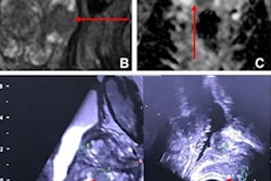 2023 07 25 21 31 5449 2023 07 25 Radiology Wei Figure4 20230725212024