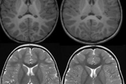 2023 07 28 21 03 7352 2023 07 26 Radiology Ai D Antonoli Image1 20230728211443