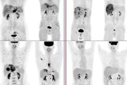 2023 07 28 21 48 6120 2023 07 31 Pet Liver 20230728215706