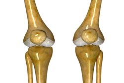2018 12 19 01 50 3936 Knee Joint 400